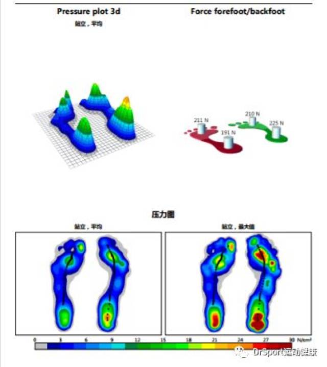 从上图可以看出,静态足底压力下,正常的足部力线是分布于双足前后掌