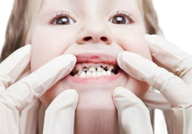 如何刷牙才不会有蛀牙 f501cc83e1fd4985adafcf63be6d3aad.jpeg