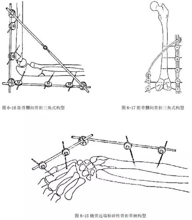 (七)骨盆骨折