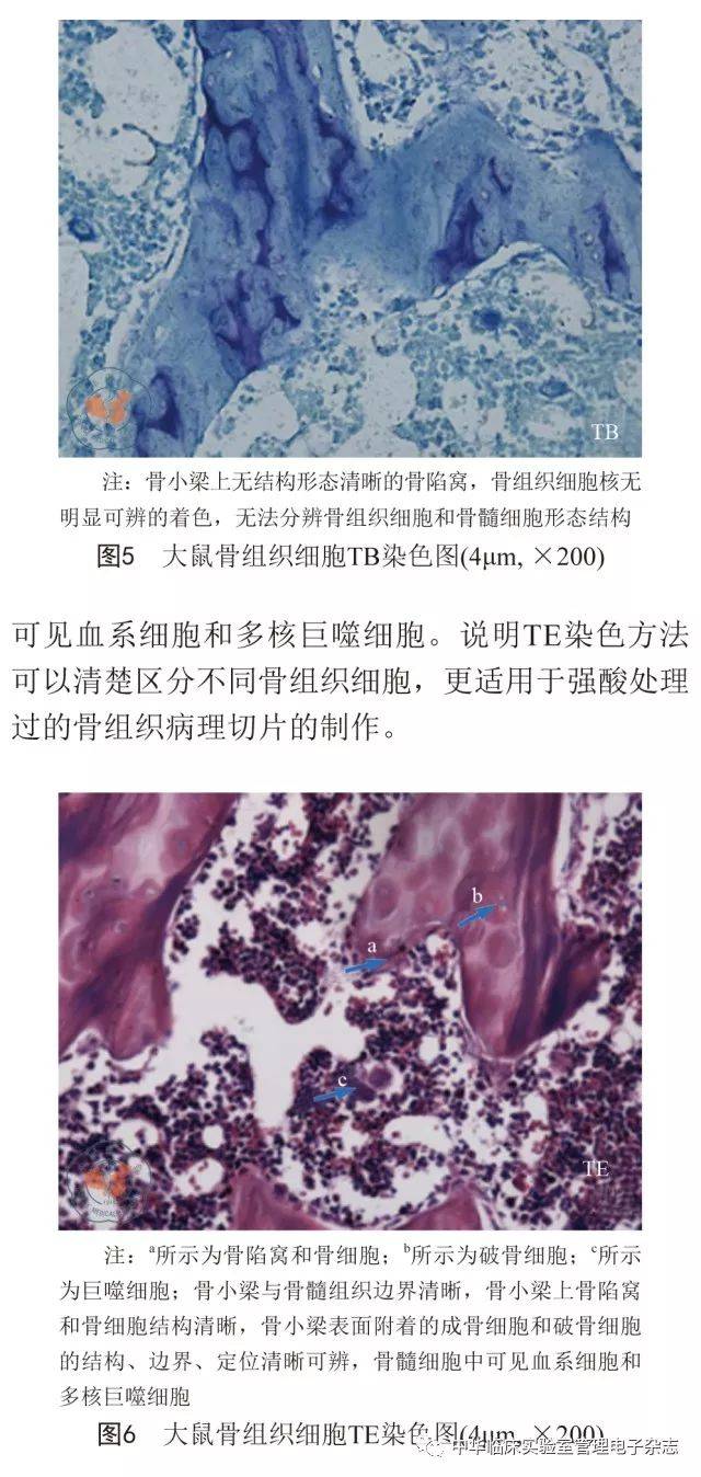 【实验研究】快速脱钙骨组织病理切片台盼蓝-伊红染色方法研究