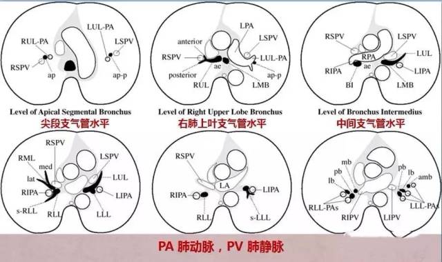 pa肺动脉,pv肺静脉