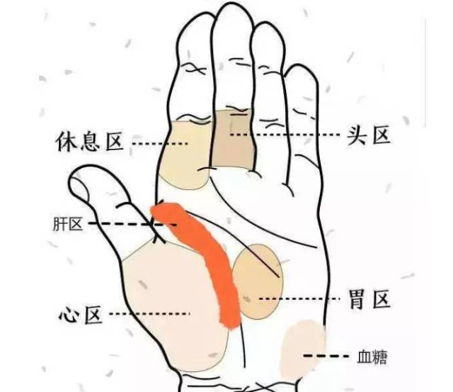 手掌有白斑-- 浅表性胃炎