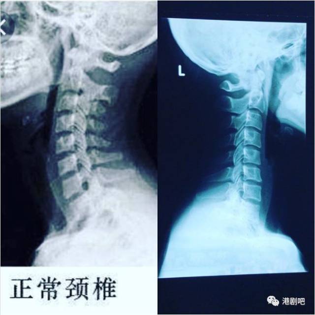 tvb索人妻于官网"下架" 坦言事前并不知情!
