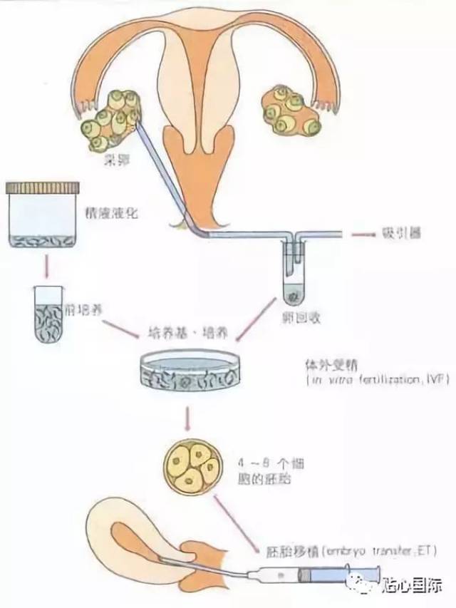 做试管婴儿取卵多少合适?