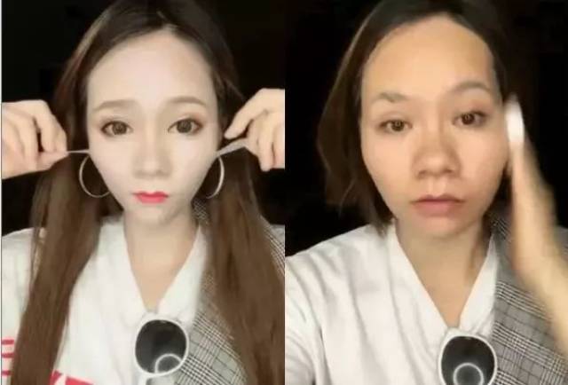 这个女艺人卸妆后直接撕掉一层皮 为了瘦脸她们真的是好拼啊