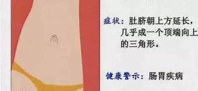 1,圆形(最健康的肚脐形状):女性肚脐若为正圆形,表示身体健康,卵巢