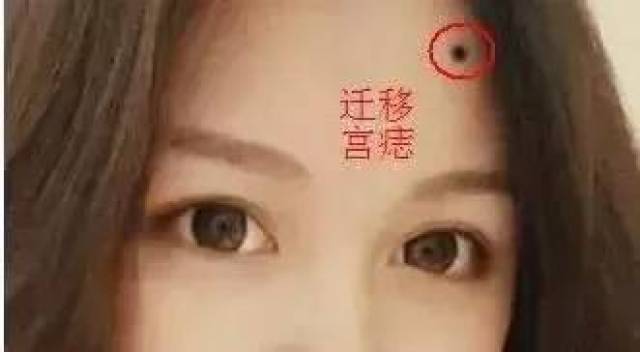 如果驿马有痣,则人一生比较奔波,与六亲缘薄,如果额头相理好,有利于外