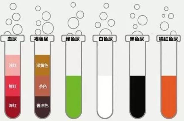 2,经常出现,泡沫久久不散—快看医生 如果尿液表面总是浮着一层细小