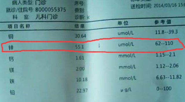 宝宝缺锌危害虽然伟大,但这样的表现,宝妈只需这样给宝宝补充就可以了