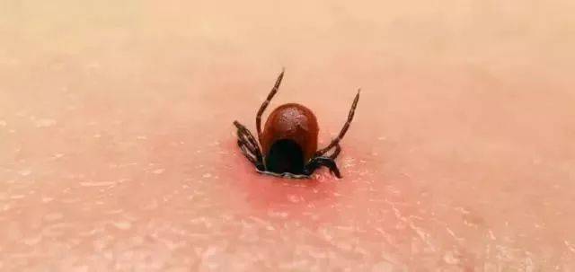 迁安人注意:唐山已有人被蜱虫咬伤请做好预防