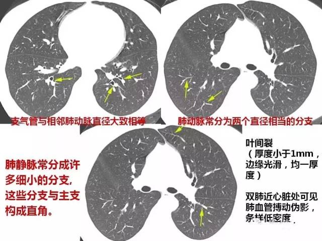 临床医师呼吸系统核心考点笔记请查收!(附解剖图)