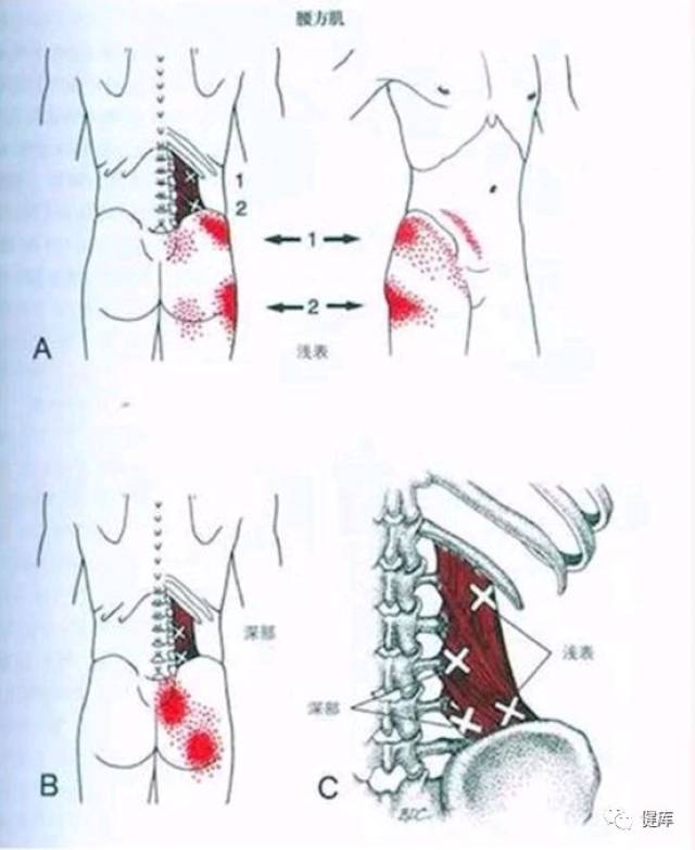 如何缓解因腰方肌而产生的疼痛呢,接下来简单为大家介绍几个拉伸和