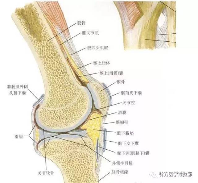 针刀治疗膝关节类风湿性关节炎