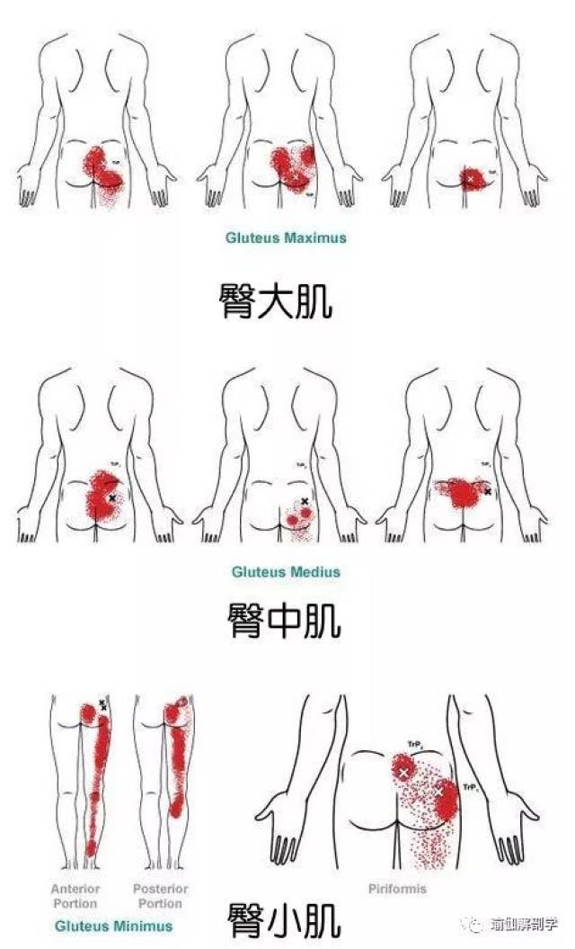 髋部打不开,髋部疼痛,一个筋膜球帮你搞定!