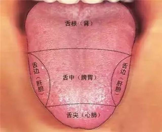 舌色暗红,舌体干,舌苔黄厚腻,舌边有红刺,口臭口苦,一位老年胃癌患者