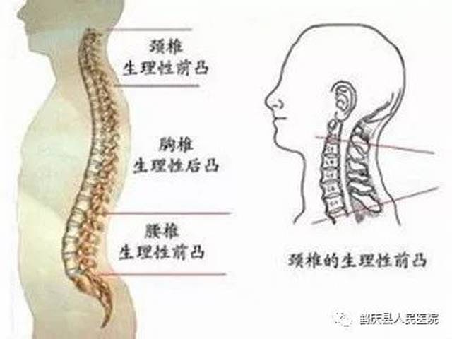 夏天颈椎病的高发原因有哪些