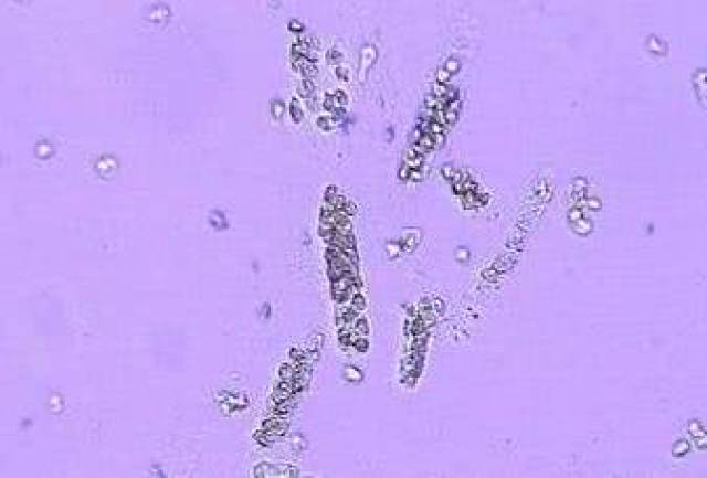 15,白细胞管型(u_wbc-c)