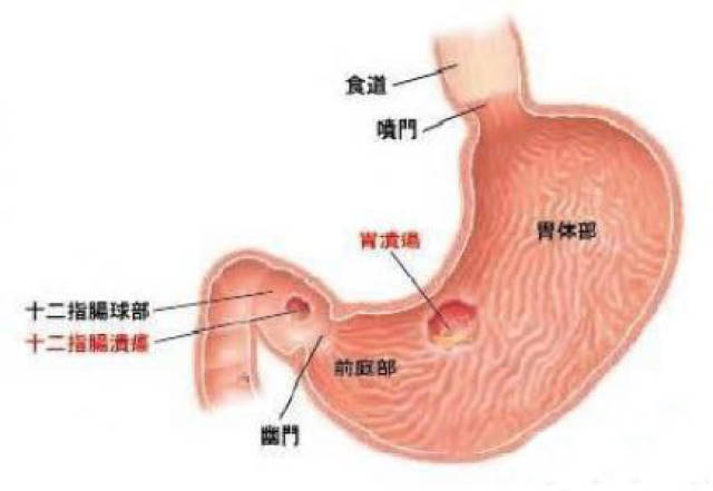 不严格遵守医嘱,频繁换服药物,或症状稍有改善立即停药,影响溃疡面