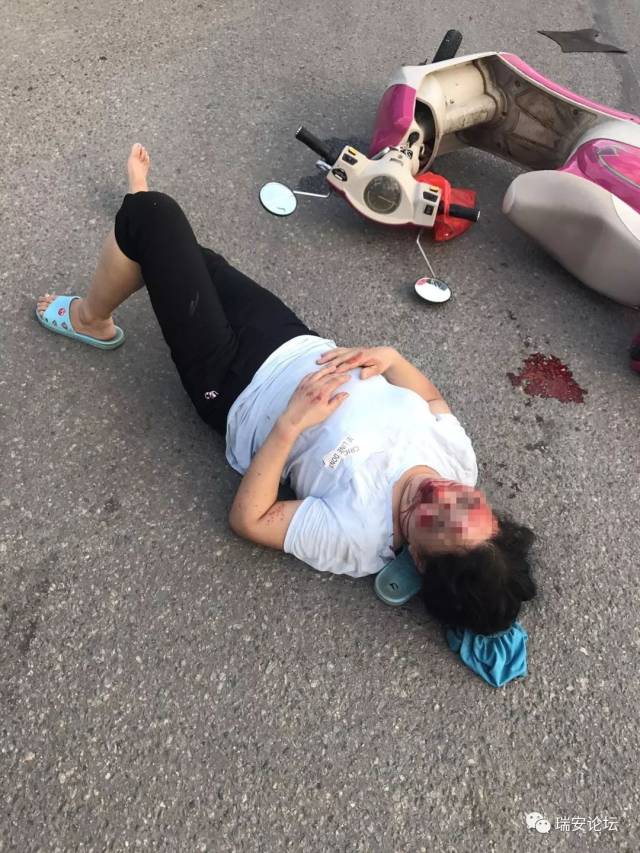 瑞安104国道突发惨烈车祸:一女子满脸是血,倒在地上