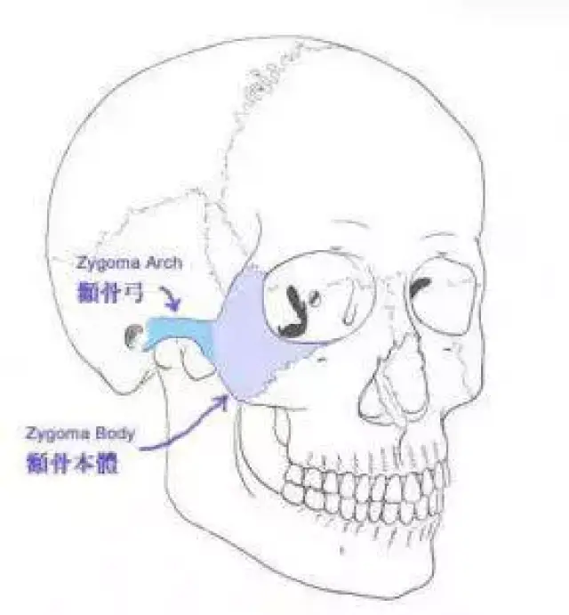 颧骨之于容貌,究竟意味着什么?