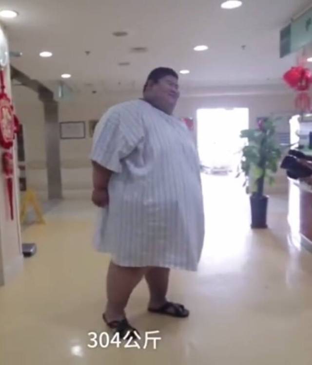 668斤"山东第一胖",切胃手术后瘦60斤!