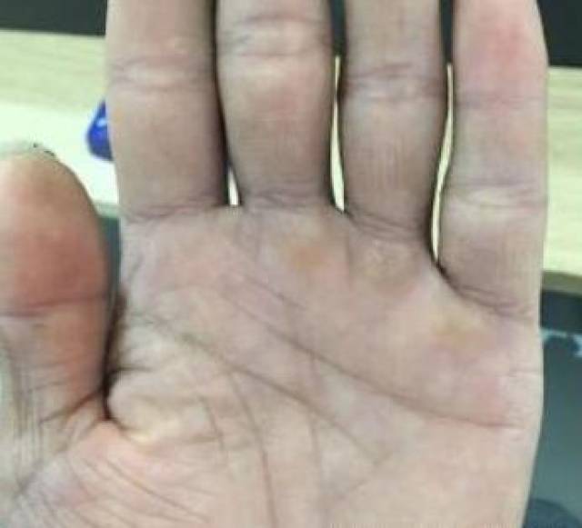 四指缝皆漏的,也容易漏财,配合指掌短,手茧重的,人多有操劳,辛苦得财.