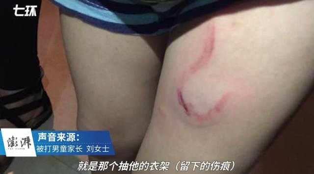 比8岁"摸臀男孩"更可气的,是这种流氓家长