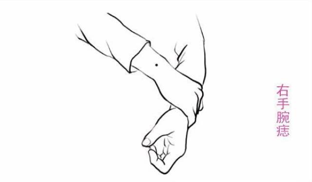 女性右手手腕长痣图解_南通好房网户型图大全