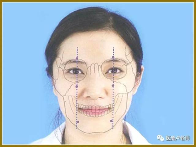 颜面区域阻滞麻醉注射点,眶上孔,眶下孔,额孔常常位于瞳孔正中线上.