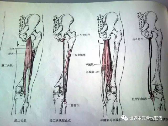 股二头肌:自坐骨结节,股粗线至腓骨小头.
