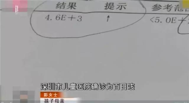 关注|幼儿接种长春长生百白破疫苗第一针后,被确诊患百日咳!
