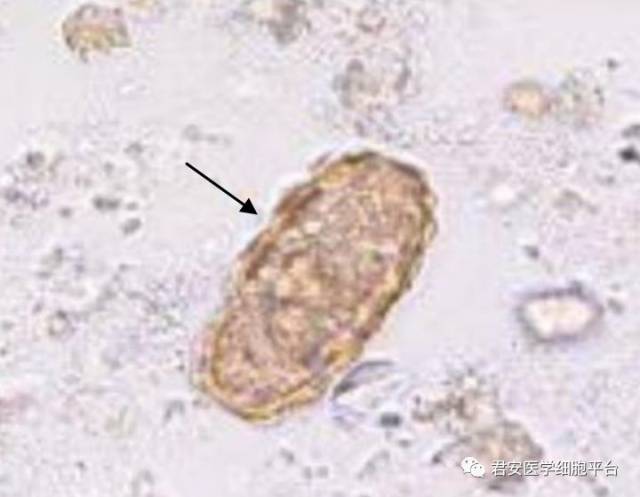 看图识细胞之"卫生部2017年寄生虫形态学质控"