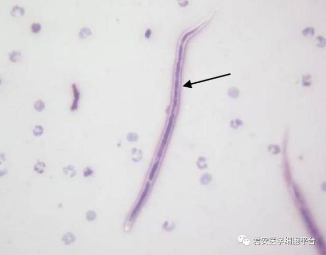 看图识细胞之"卫生部2017年寄生虫形态学质控"