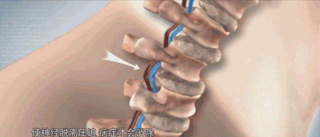 因此,只要睡前睡牵引枕30分钟,就能轻松缓解颈椎疼痛.