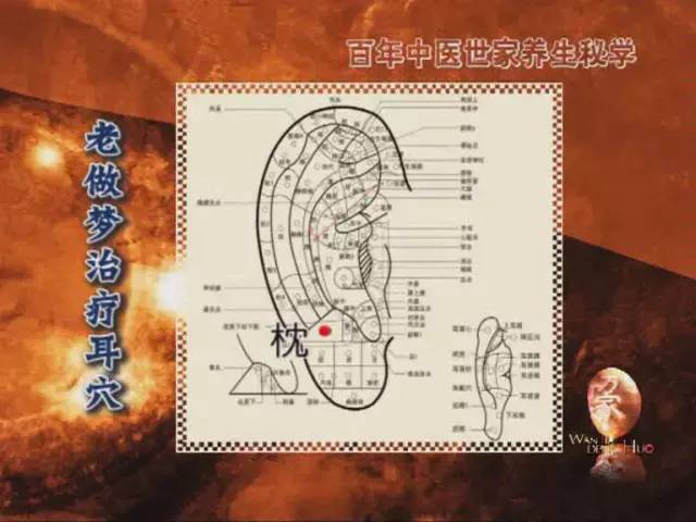 【国医课堂】国医大师的绝招,耳穴治失眠!