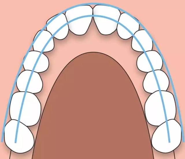 牙齿矫正可以让面型变得协调 牙齿的形态与牙列的形态,脸型有一定的