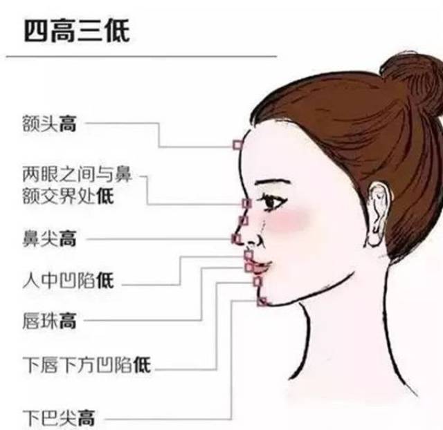 鼻尖,唇珠,下巴尖都高,"三低"指的是两眼之间与鼻额交界处,人中凹陷