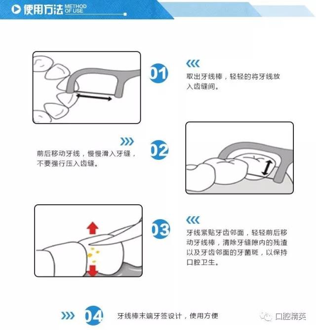 很多人以为用不用牙线都无所谓,其实不然.