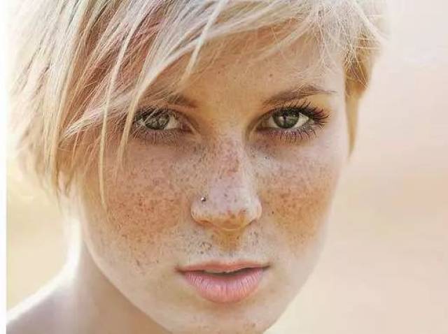 什么是青春痘青春痘长什么样 b47fdb65e65242ddb0cf2c59a4bb3e09.jpeg