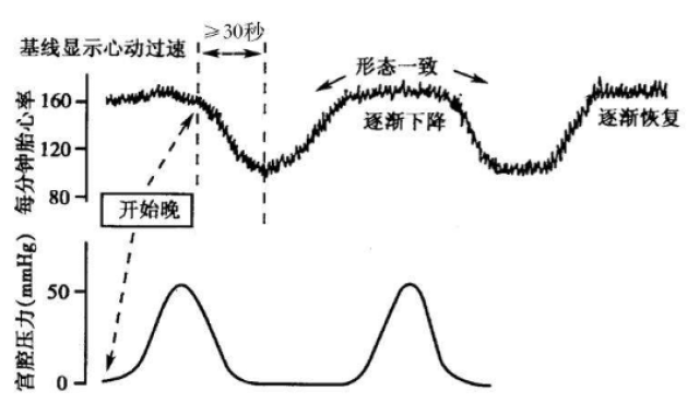 指标五:胎心率