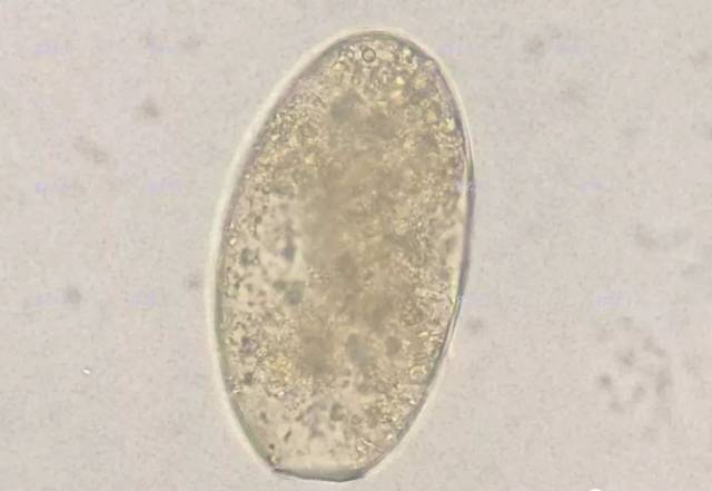 胚膜内含物:六钩蚴 图11 虫卵名称:曼氏迭宫绦虫卵 虫卵的特征: 大小