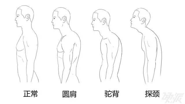 颈椎病,圆肩驼背的原因,它有什么危害?你应该知道.