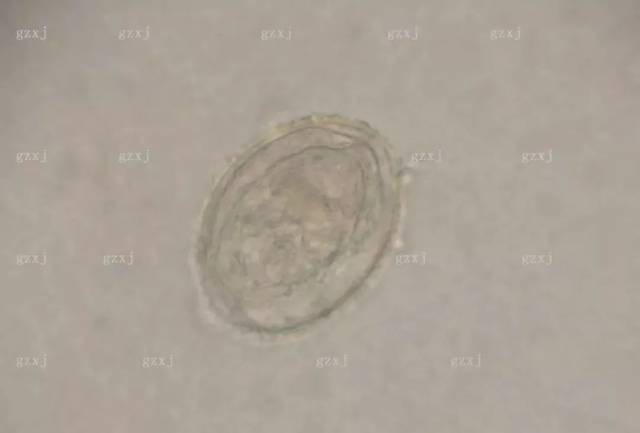 图7 虫卵名称:日本血吸虫卵 虫卵的特征: 大小:70106umx5080um 外形