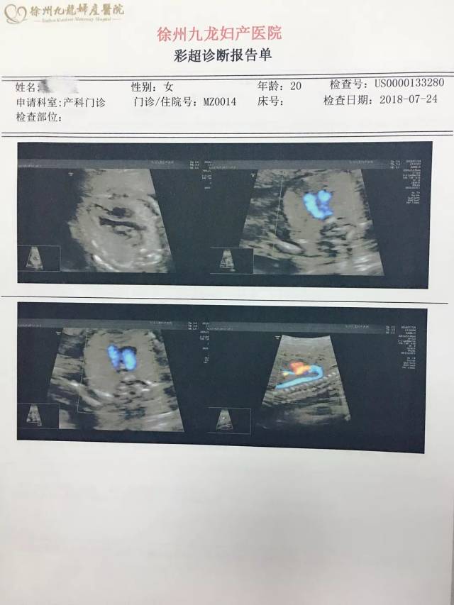 孕22周宝妈做四维彩超,筛查出胎儿是"先天性心脏病"