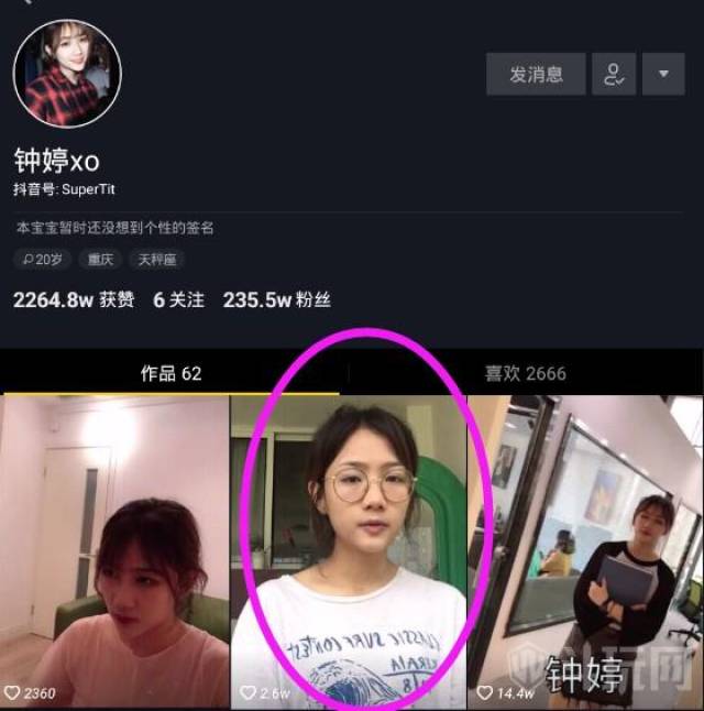 钟婷有整容吗 钟婷xo整容前后对比照片_手机搜狐网