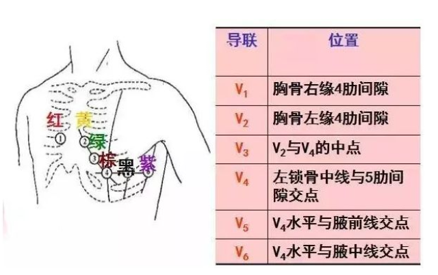 由于这些导联的电极位置各不相同,因此,它们所代表的含义也有不同.