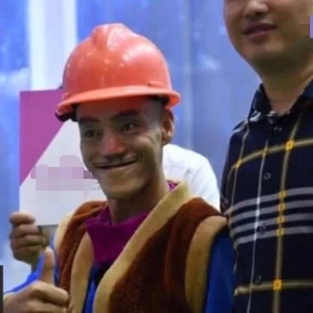 靠丑出名的网红,因太像光头强而一炮走红,网友:人生赢家
