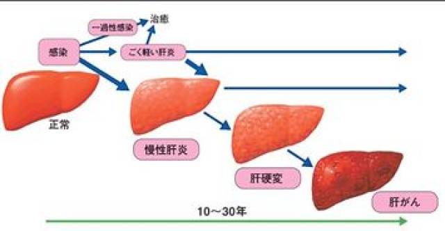 肝脏是人体最大的腺体,血供丰富,功能复杂,因此特别容易生病.