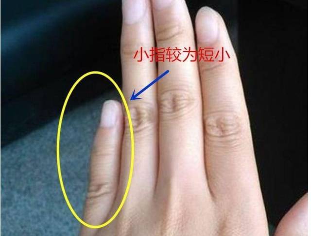 小拇指长短看财运 弯曲代表什么
