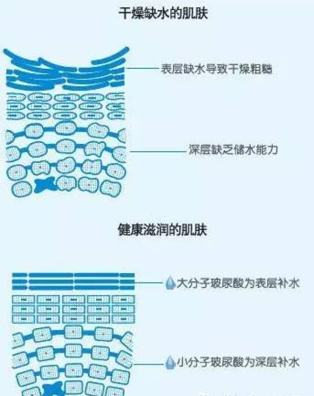 【医美】小知识 | 玻尿酸大分子和小分子的区别,你知道吗?